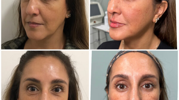 The Eternia Medspa Consultation Experience
