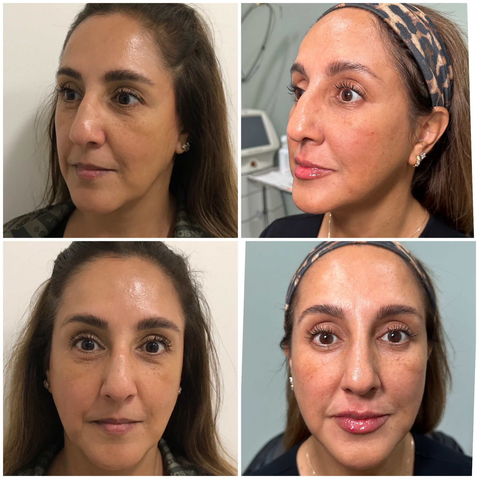 The Eternia Medspa Consultation Experience